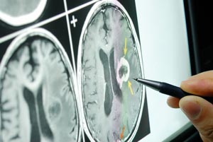 Patient Resources